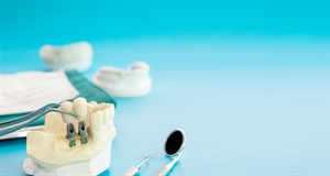 How Is A Dental Cleaning Done? thumbnail